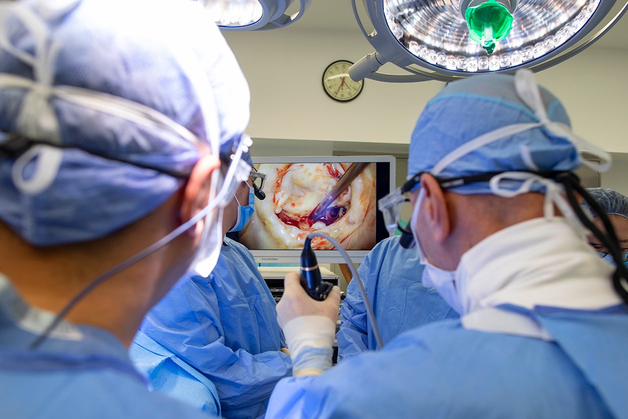 Dr. Adams examines the mitral valve during a re-operative procedure. 