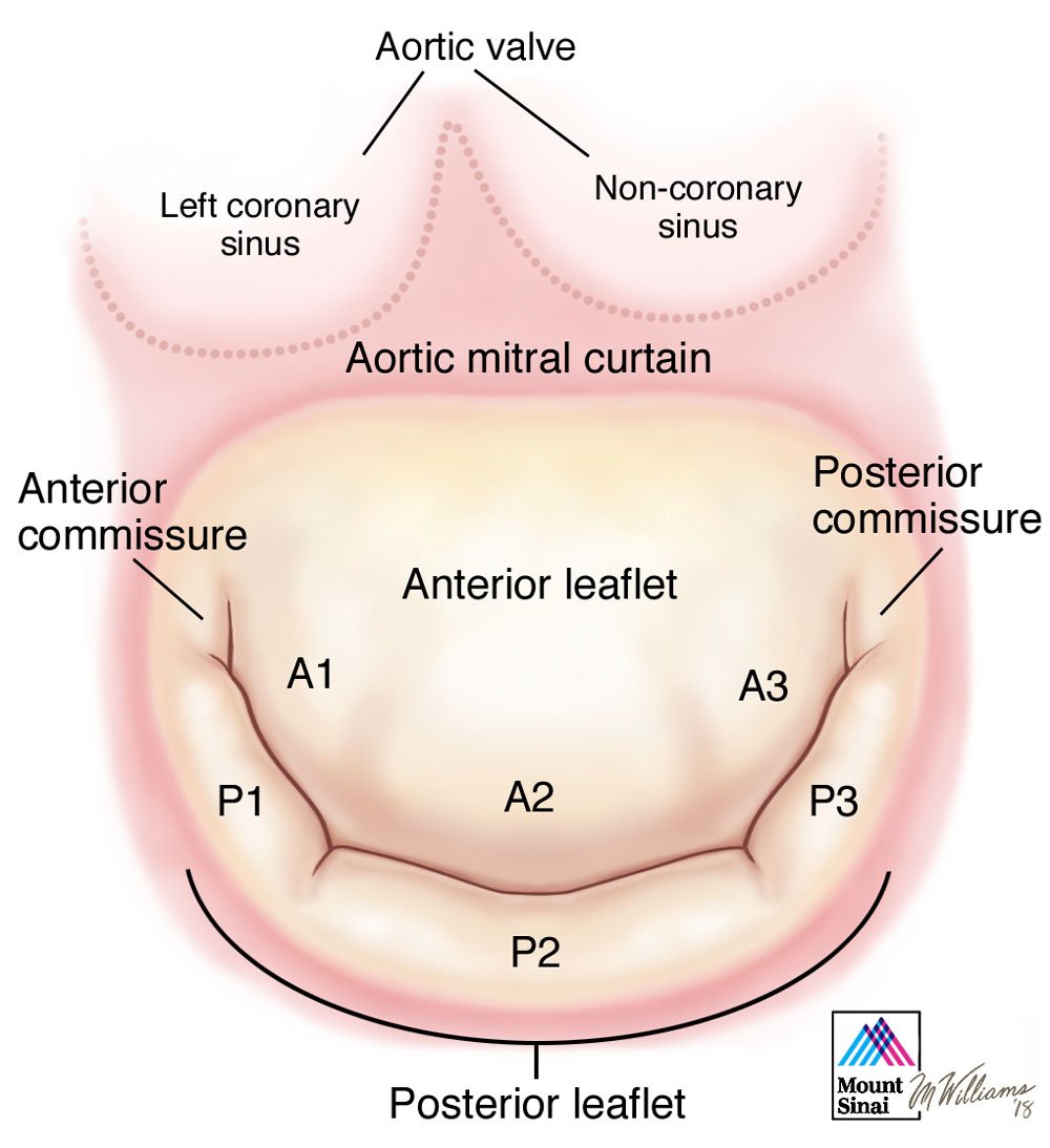 mitral valve posterior leaflet